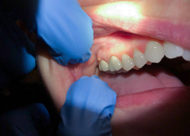  Wentworth, NC Emergency Dentist Pros