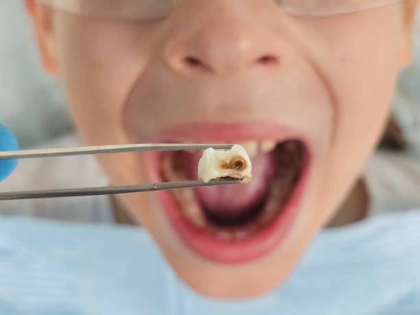 Best Cosmetic Emergency Dentistry in Wentworth, NC