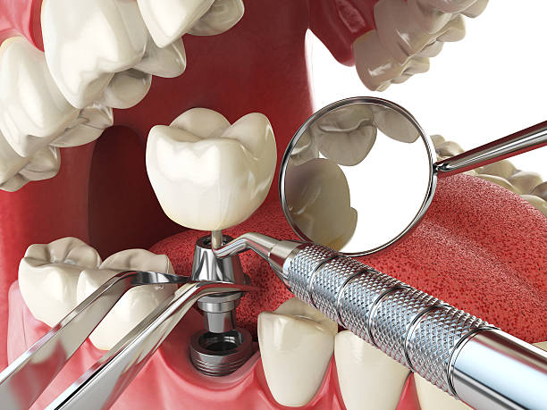 Best Emergency TMJ Treatment in Wentworth, NC